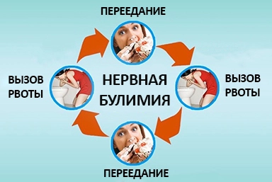 Лечение булимии в Камбарке